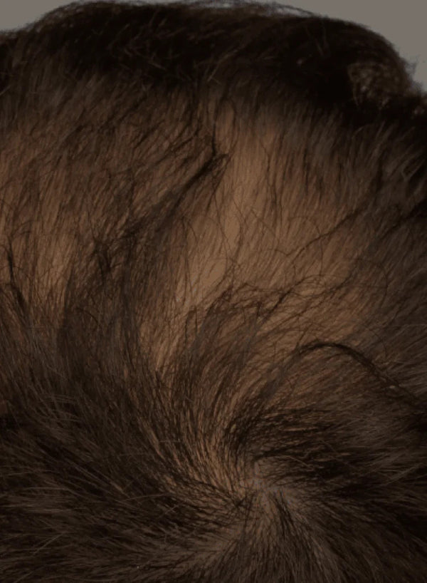 Thinning at the Crown